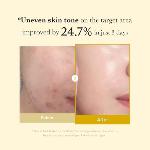 Medicube Kojic Acid Turmeric Night Wrapping Mask 75ml NZ