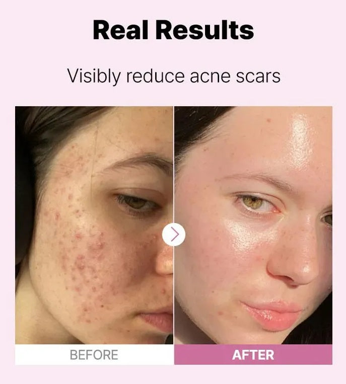 Buy COSRX Niacinamide 15 Serum 20ml online NZ