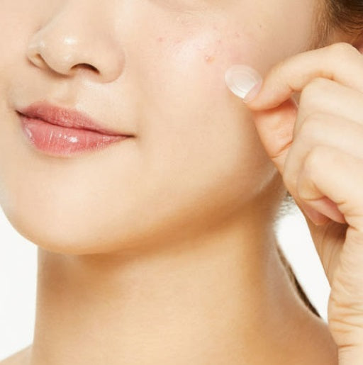 Fast healing acne patch for irritated skin NZ