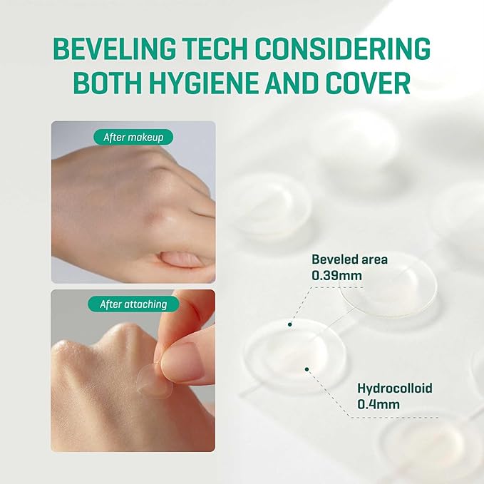 Acne healing patches 10mm and 12mm
