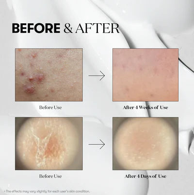 VT COSMETICS REEDLE SHOT 300 NZ