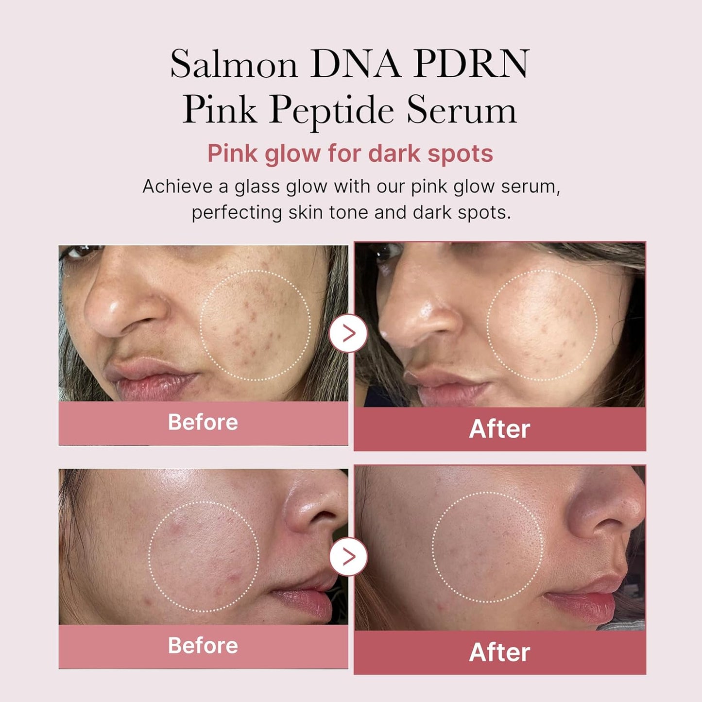 Hydrating and firming Medicube PDRN serum NZ