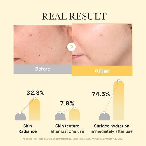 MEDICUBE Kojic Acid Turmeric Brightening Gel Mask NZ