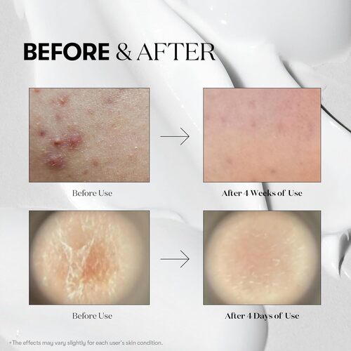 Anti-aging serum firming and hydrating Reedle Shot 50ml NZ