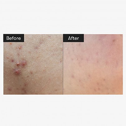 K-beauty ampoule 50ml fast delivery in New Zealand