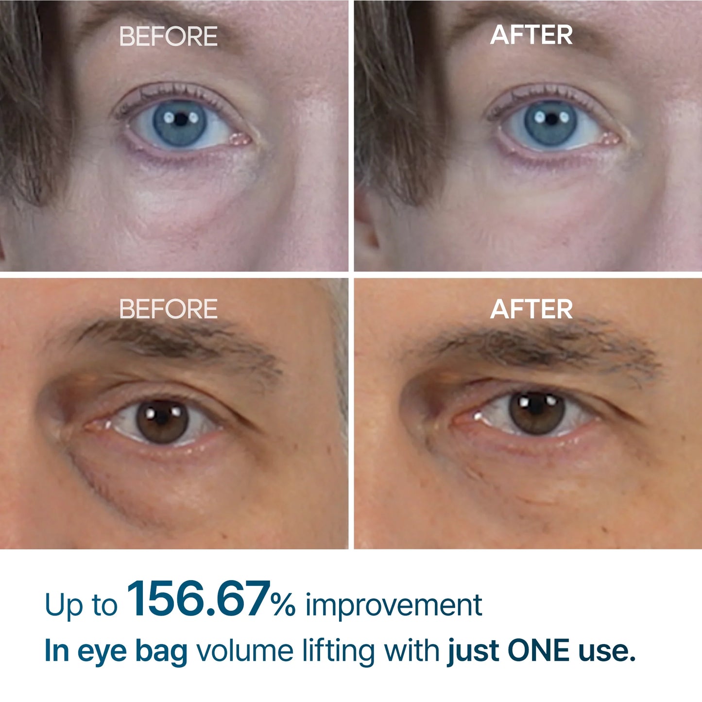 [Dr. Melaxin] EYEPHALT EYECREAM FOR EYEBAGS 10ML