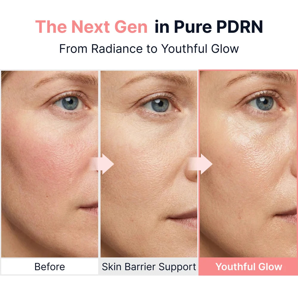 SUNGBOON EDITOR PDRN Pink Vitamin Glow Ampoule | K-beauty NZ