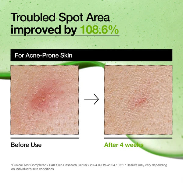 [Anua] azelaic acid 10 hyaluron redness soothing serum 30ml