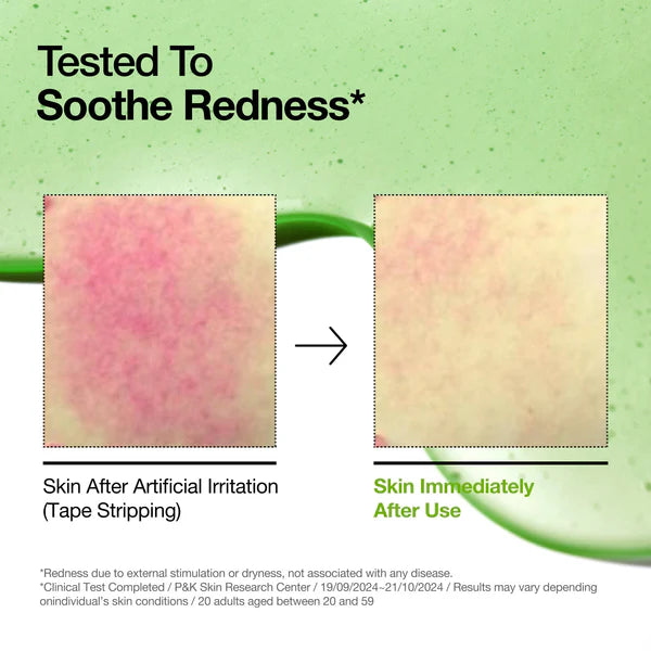 [Anua] azelaic acid 10 hyaluron redness soothing serum 30ml