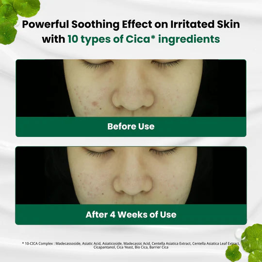 [Dr.G] RED BLEMISH CLEAR SOOTHING CREAM 70ML