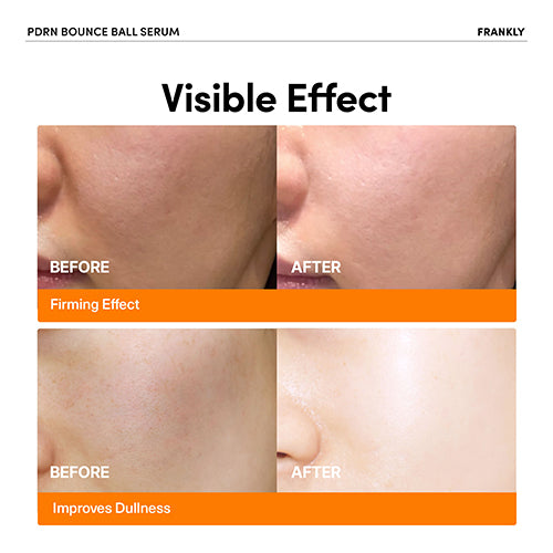 FRANKLY Anti-aging elasticity serum